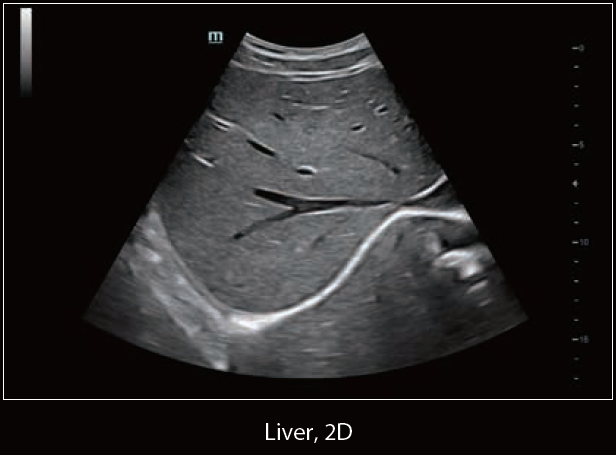 Mindray Ultrasound DC-60 EXP