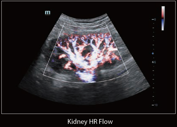 Mindray Ultrasound DC-60 EXP