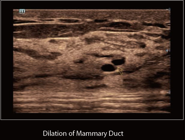 Mindray Ultrasound DC-60 EXP