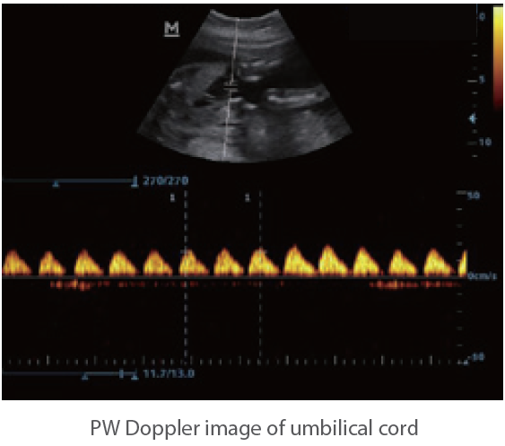 Mindray Ultrasound DP-10