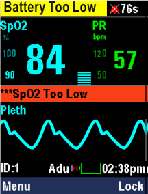 Mindray Pulse Oximeter PM-60