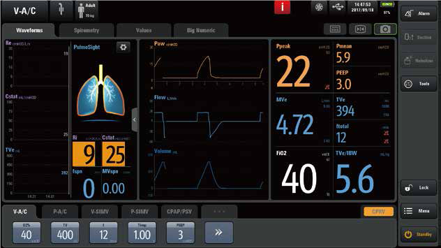 Mindray Ventilator SV800