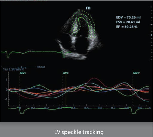 Mindray Ultrasound DC-8EXP