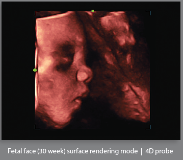 Mindray Ultrasound DC-8EXP