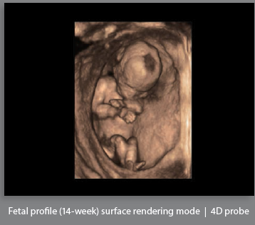 Mindray Ultrasound DC-8EXP