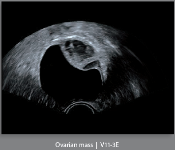 Mindray Ultrasound DC-8EXP