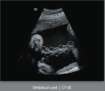 Mindray Ultrasound DC-8EXP