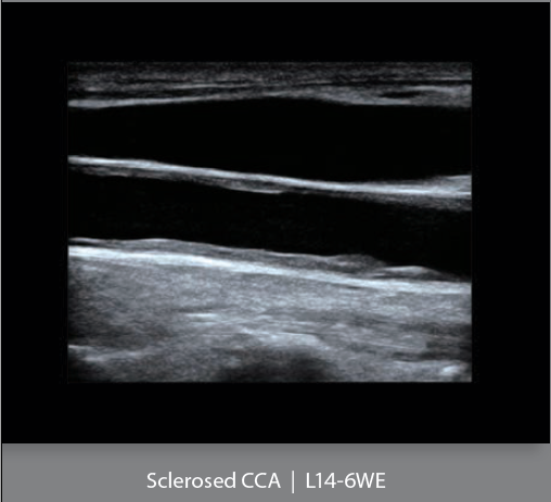 Mindray Ultrasound DC-8EXP