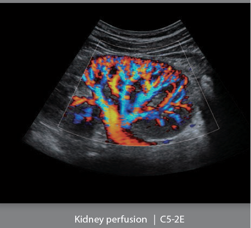 Mindray Ultrasound DC-8EXP