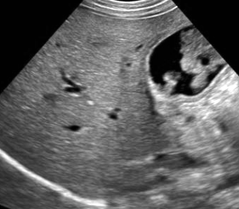Mindray Ultrasound DC-8EXP