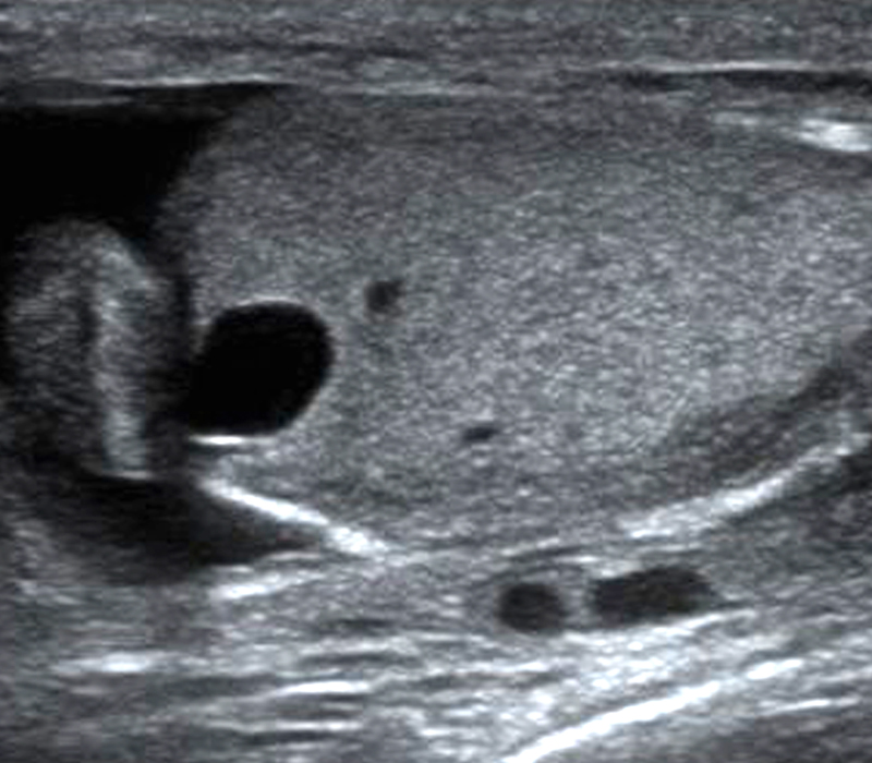 Mindray Ultrasound DC-8EXP