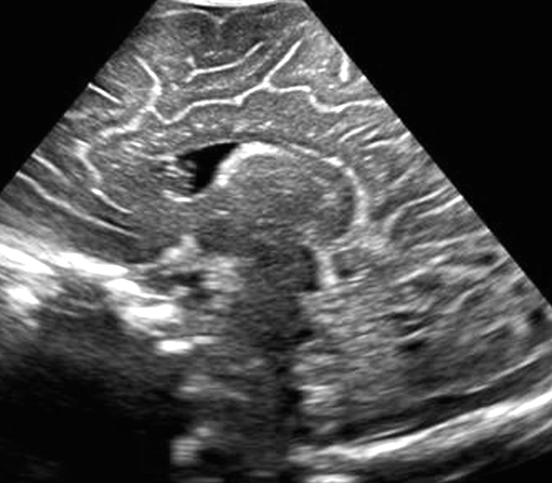 Mindray Ultrasound DC-8EXP