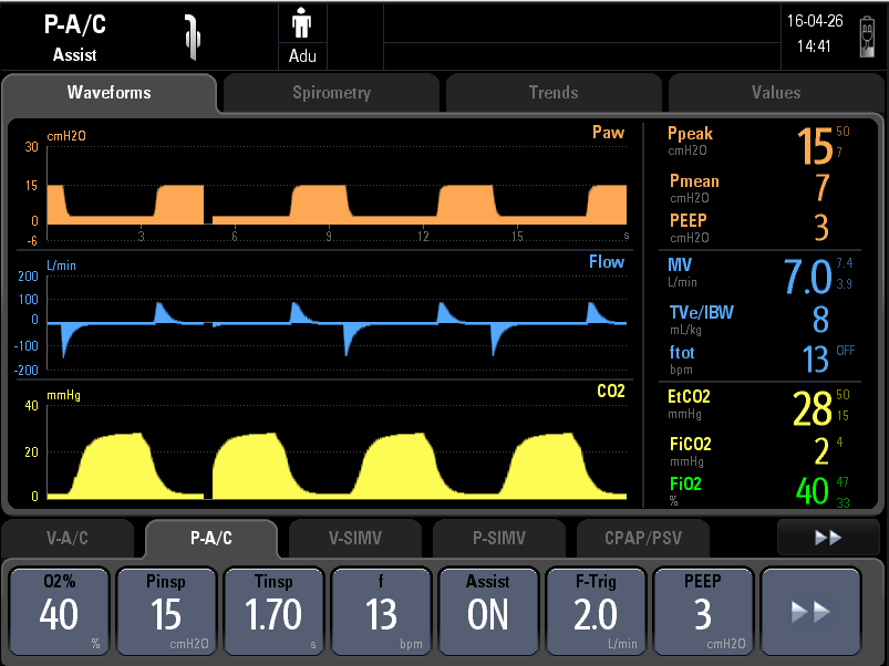Mindray Ventilator SynoVent E5