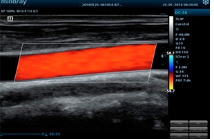 Mindray Ultrasound DC-30
