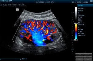 Mindray Ultrasound DC-30