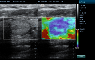 Mindray Ultrasound DC-30