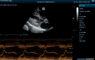 Mindray Ultrasound DC-30