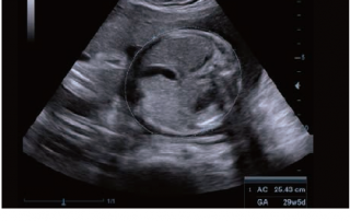 Mindray Ultrasound DC-40HD