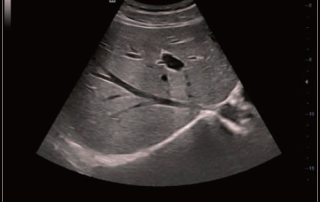 Mindray Ultrasound DC-40HD
