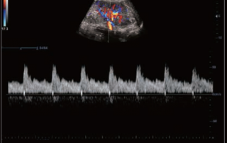 Mindray Ultrasound DC-40HD