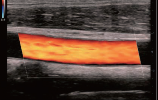 Mindray Ultrasound DC-40HD