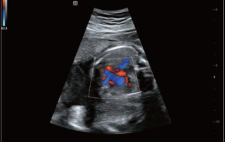 Mindray Ultrasound DC-40HD