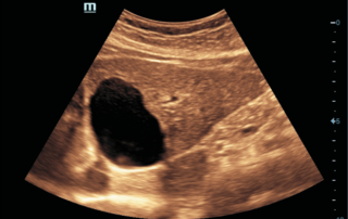 Mindray ultrasound DC-60