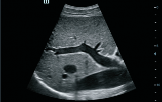 Mindray ultrasound DC-60