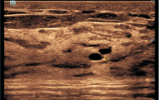 Mindray ultrasound DC-60