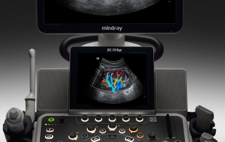 Mindray Ultrasound DC-70 EXP