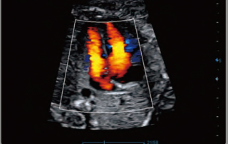 Mindray Ultrasound DC-70EXP