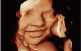 Mindray Ultrasound DC-70EXP