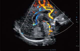 Mindray Ultrasound DC-70EXP