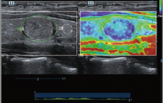 Mindray Ultrasound DC-70EXP