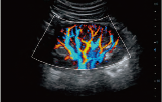 Mindray Ultrasound DC-70EXP