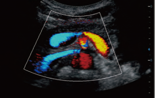 Mindray Ultrasound DC-70EXP