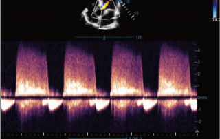Mindray Ultrasound DC-70EXP