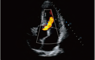 Mindray Ultrasound DC-70EXP
