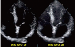 Mindray Ultrasound DC-70EXP