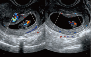 Mindray Ultrasound DC-70EXP