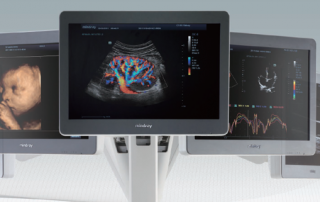 Mindray Ultrasound DC-8