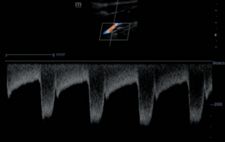 Mindray Ultrasound DC-8
