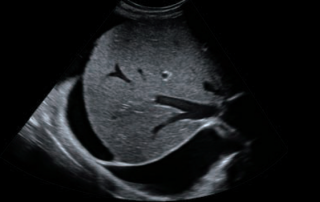 Mindray Ultrasound DC-8