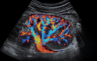 Mindray Ultrasound DC-8