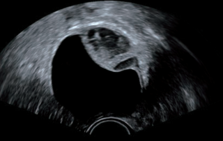 Mindray Ultrasound DC-8