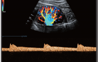 Mindray Ultrasound DC-80
