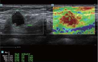 Mindray Ultrasound DC-80