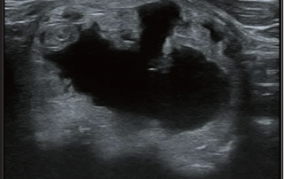 Mindray Ultrasound DC-80