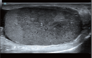 Mindray Ultrasound DC-80