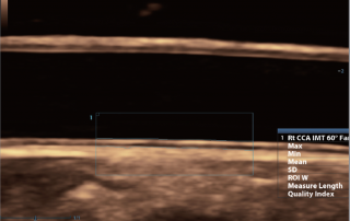Mindray Ultrasound DC-80